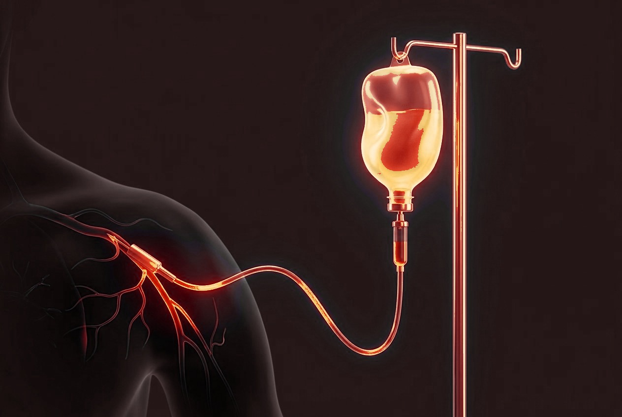 Fifteen minute IV infusion